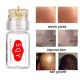 Hydra Stamp 0.25mm CLETINA Microneedle Derma Stamp For Face Body Beard Hair Growth for Home Use Hydra Stamp 0.25mm CLETINA Microneedle Derma Stamp For Face Body Beard Hair Growth for Home Use