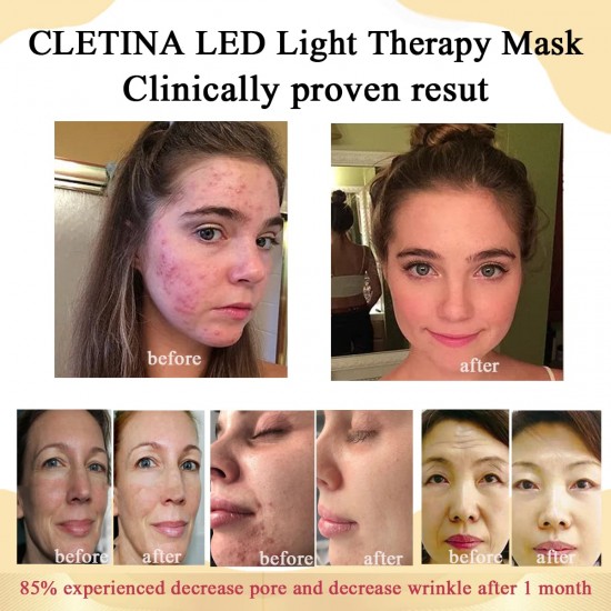 CLETINA Led Face Mask Light Therapy, Flexible Silicone 7 Colors Light,Portable Anti-Aging LED MASK, Red & Blue Light Therapy for Wrinkles, Rejuvenation & Tightening,Wrinkle Reduction CLETINA Led Face Mask Light Therapy, Flexible Silicone 7 Colors Light,Portable Anti-Aging LED MASK, Red & Blue Light Therapy for Wrinkles, Rejuvenation & Tightening,Wrinkle Reduction